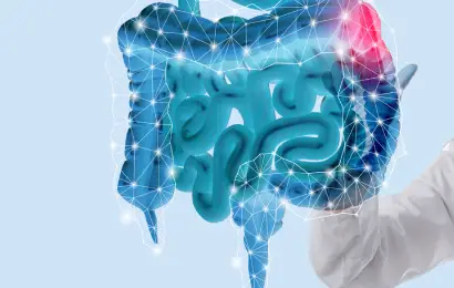 Pólipos del colon y el recto